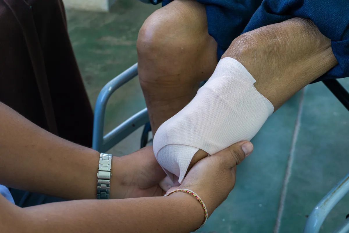 someone is putting a bandage on the leg of a man